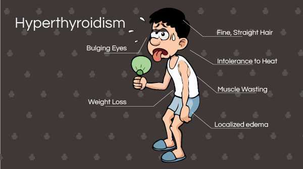 Signs and Symptoms of Hyperthyroidism