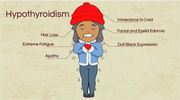 Signs and Symptoms of Hypothryoidism