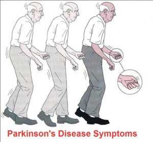 Symptoms of Parkinson 
