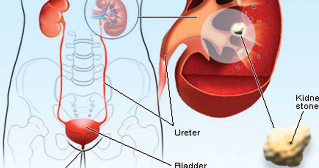 Ways to Relieve Urinary Bladder Problems