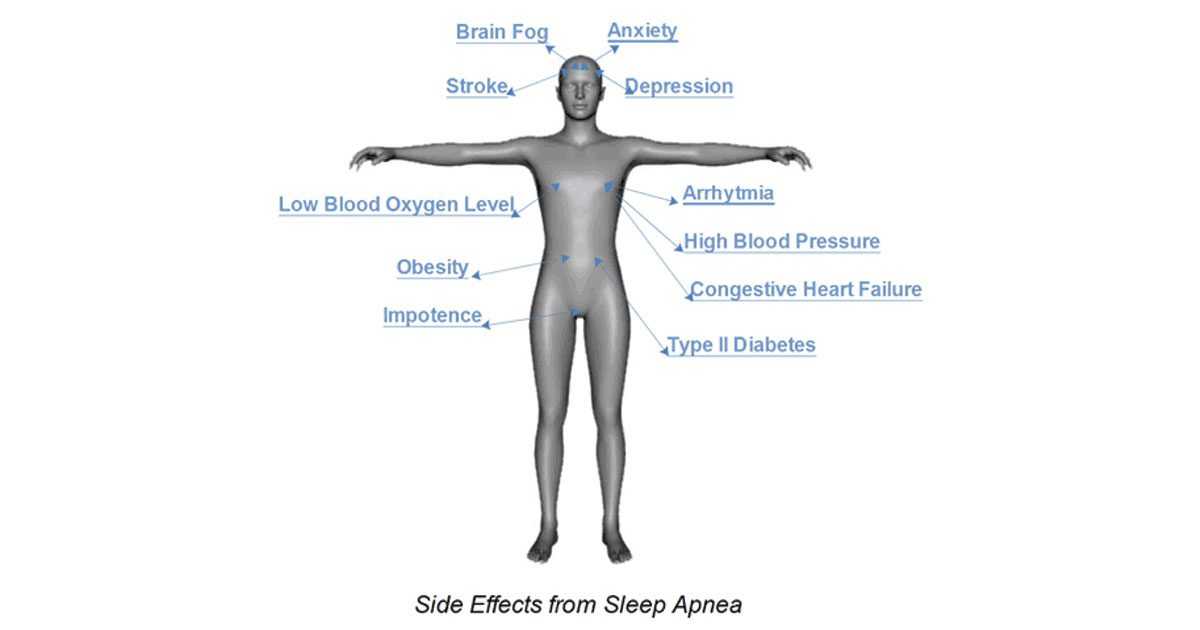 side effects of sleep apnea