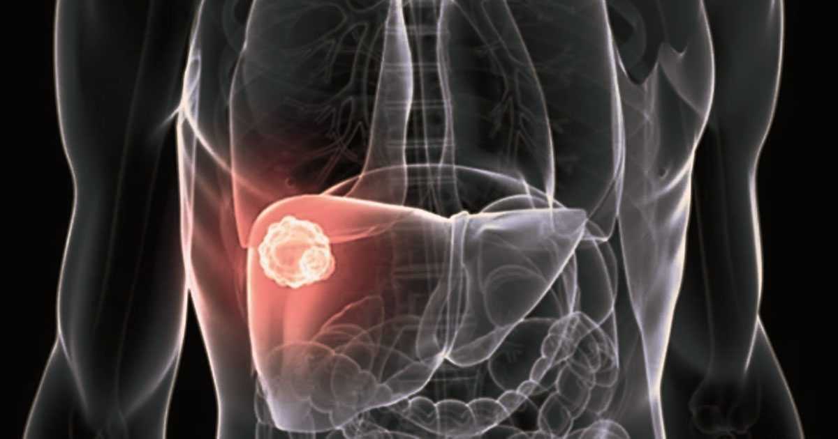 signs of liver inflammation