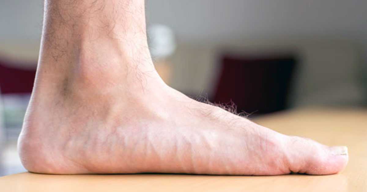 reasons behind heel pain