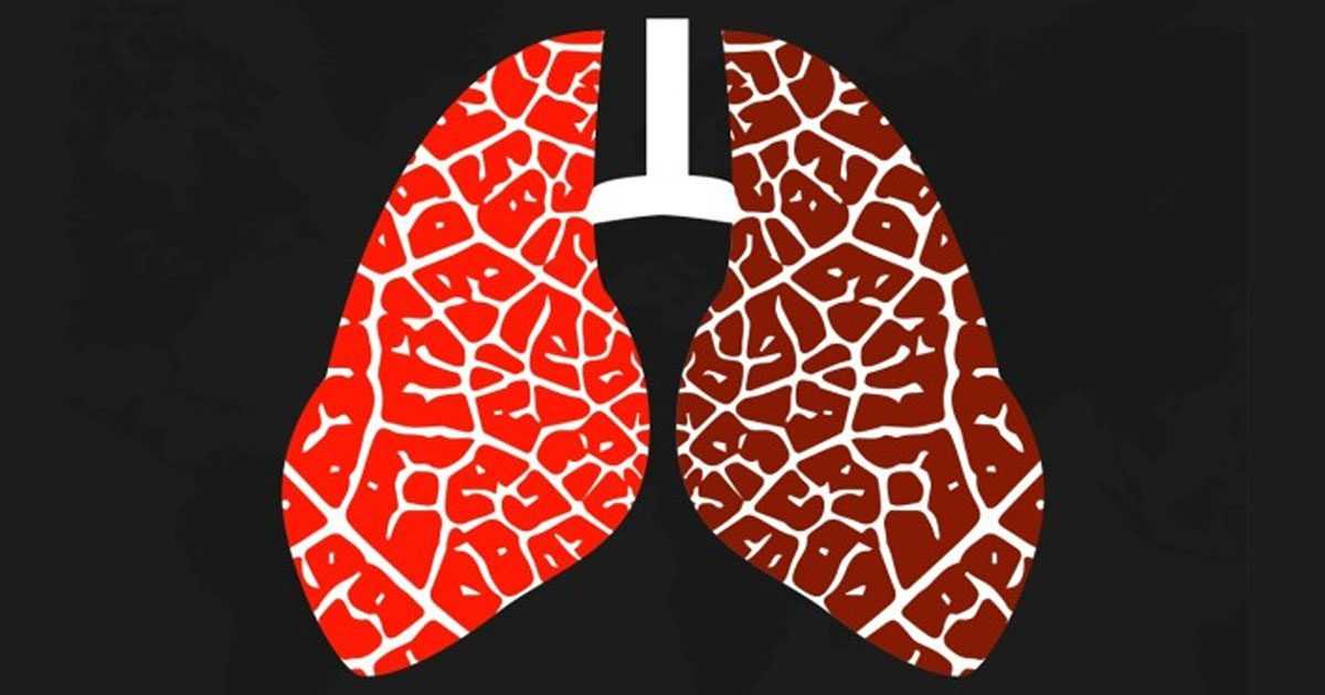 pulmonary diseases