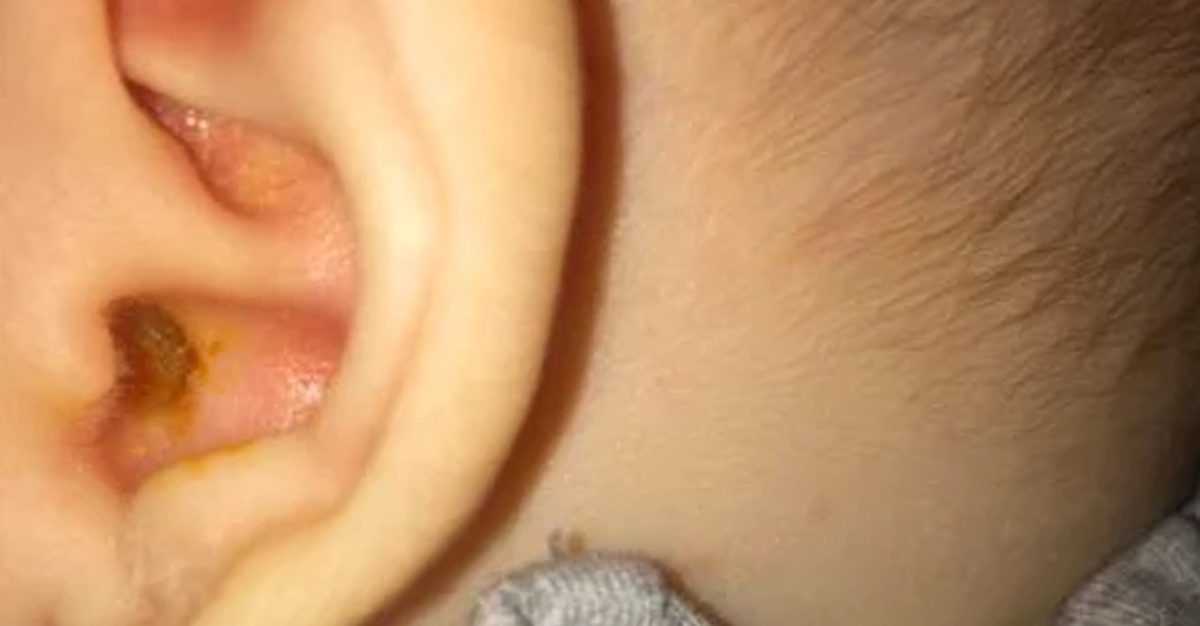 ear-wax