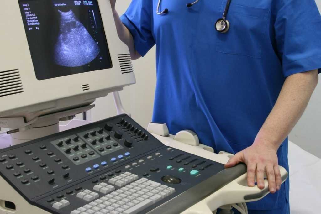best ultrasound machine in Pakistan for sonologist