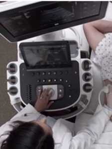 High-End General Imaging ultrasound machine 