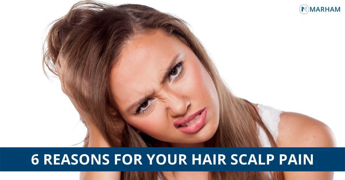 Hair Scalp Pain: The 6 Weird Reasons | Marham
