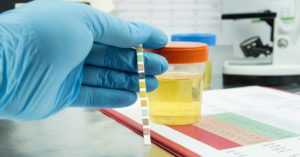 4 Reasons Why do Gynecologists Do Urine Tests