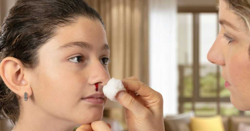 nose bleeding in children