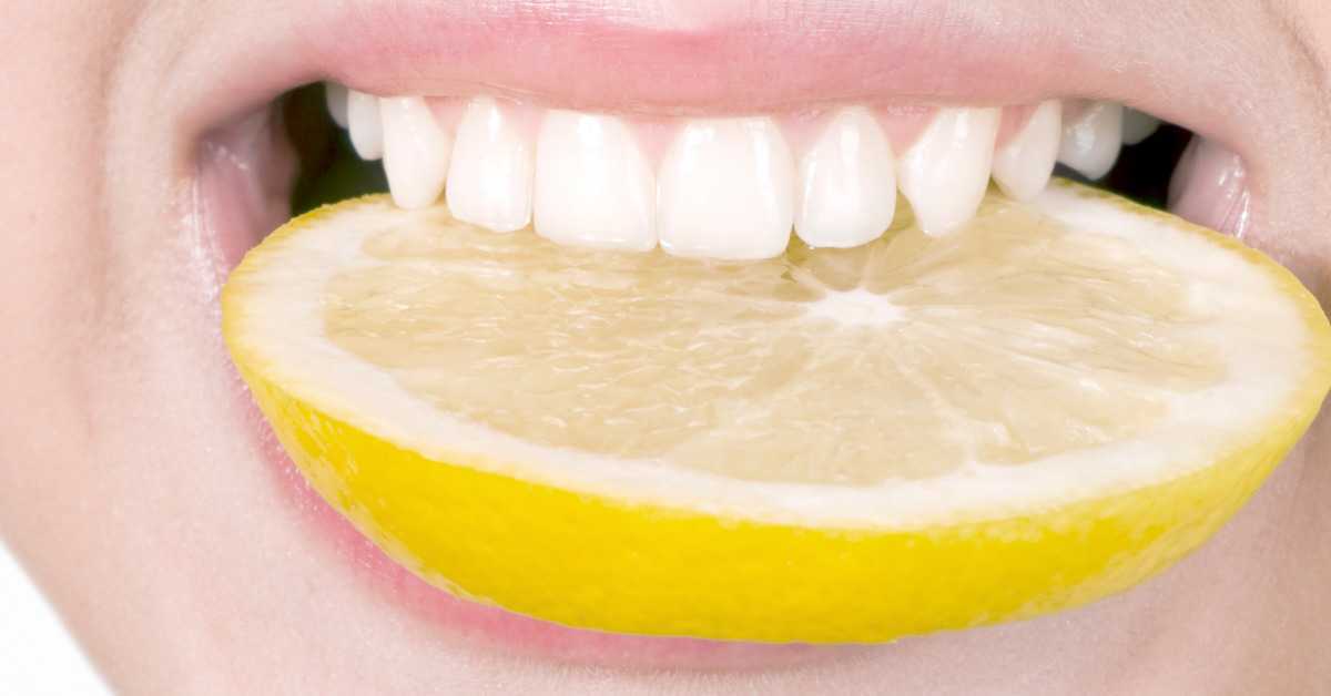 treat yellow teeth