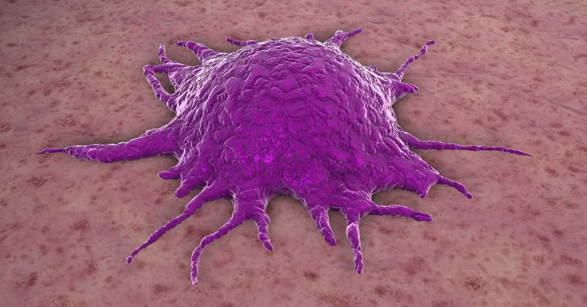 How are Tumor Cells Different from Normal Cells