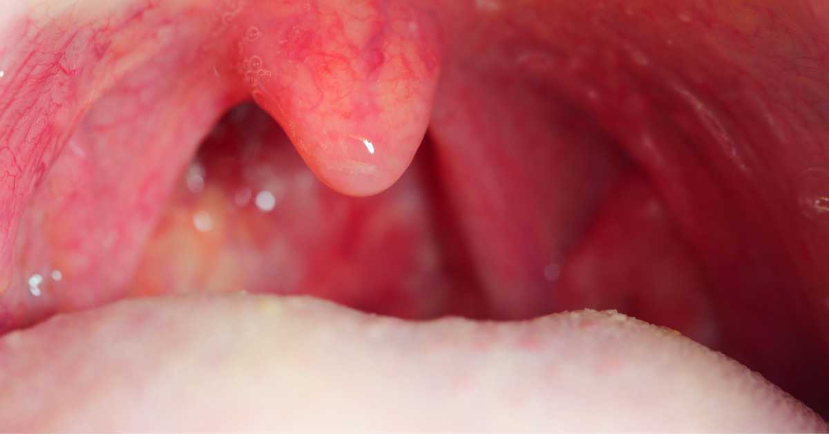 How To Get Rid Of Phlegm In Throat?