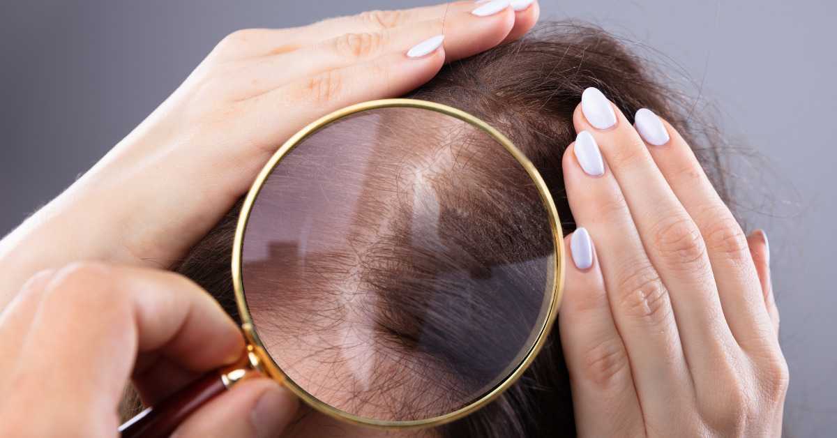 Can Hard Water Cause Hair Loss?