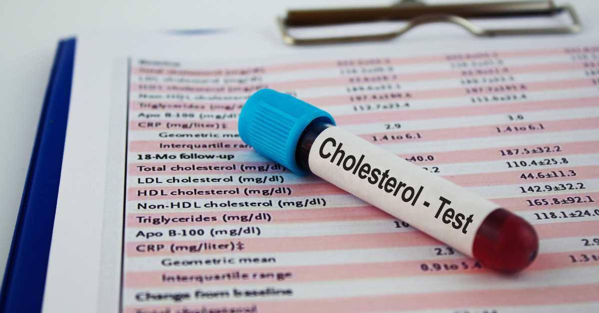 Cholesterol Levels in Pregnancy