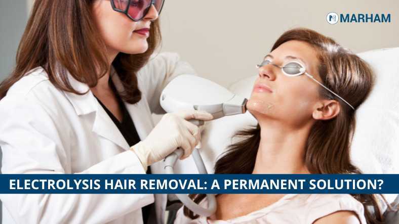 Electrolysis Hair Removal: All Details and Price in Pakistan 2022 | Marham