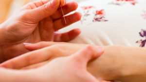 benefits of acupuncture in pregnancy
