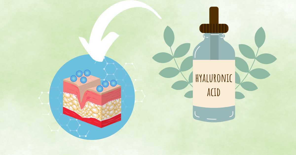 is hyaluronic acid good for oily skin 