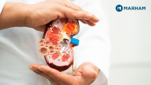 Causes of High Creatinine Levels