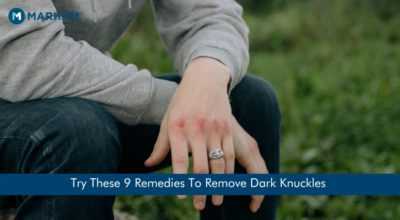 How to Remove Dark Knuckles in one Week