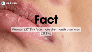 Facts About Dry Mouth
