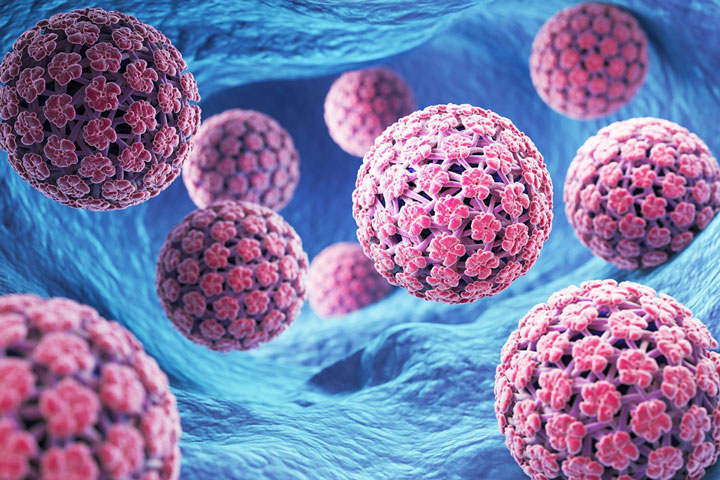 HPV (Human Papillomavirus)