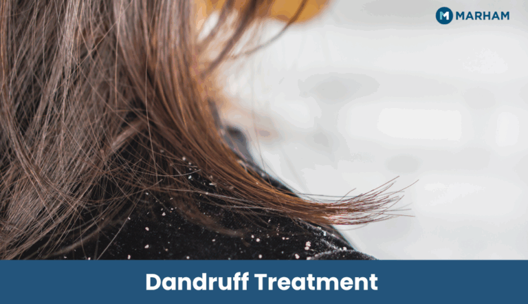Dandruff Treatment in Pakistan: Causes, Symptoms & Best Solutions Dandruff Treatment