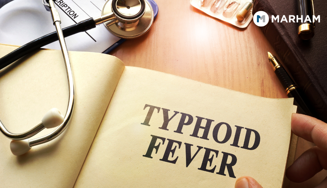 typhoid fever