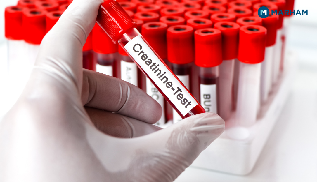 8 Proven Ways to Lower Creatinine Levels