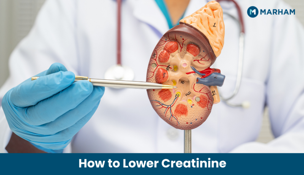How to Lower Creatinine Naturally