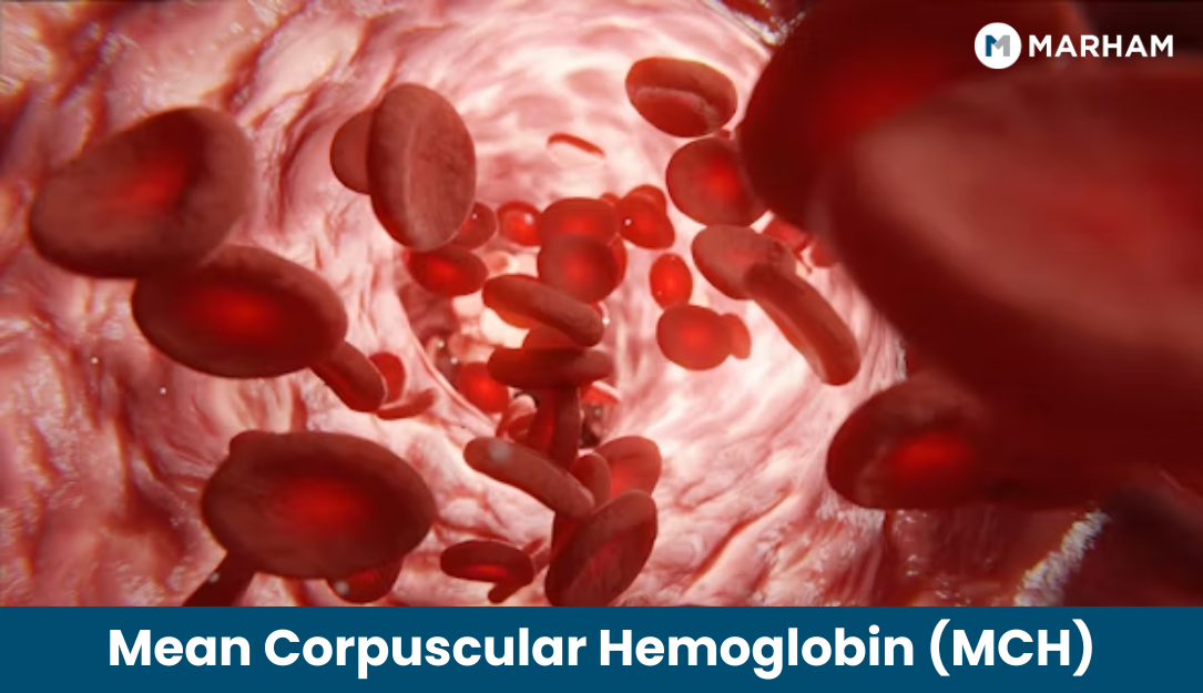 MCH Blood Test High Symptoms