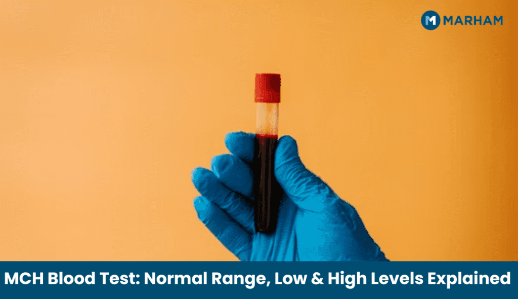MCH Blood Test: Normal Range, Low & High Levels Explained MCH Blood Test Normal Range, Low & High Levels Explained