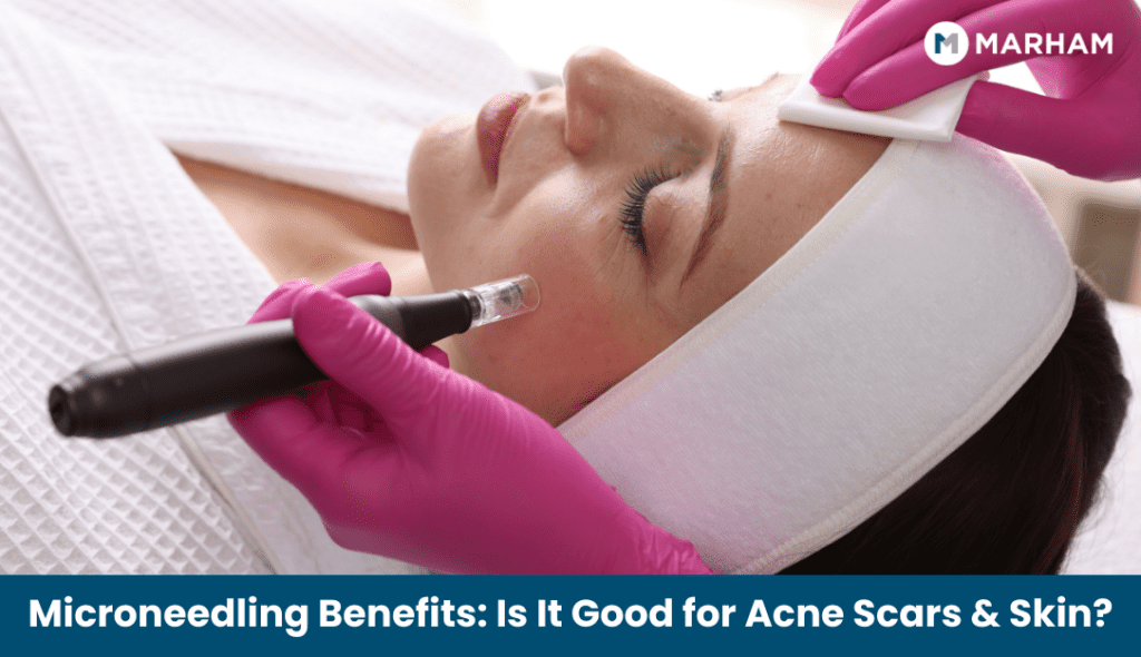 Microneedling Benefits