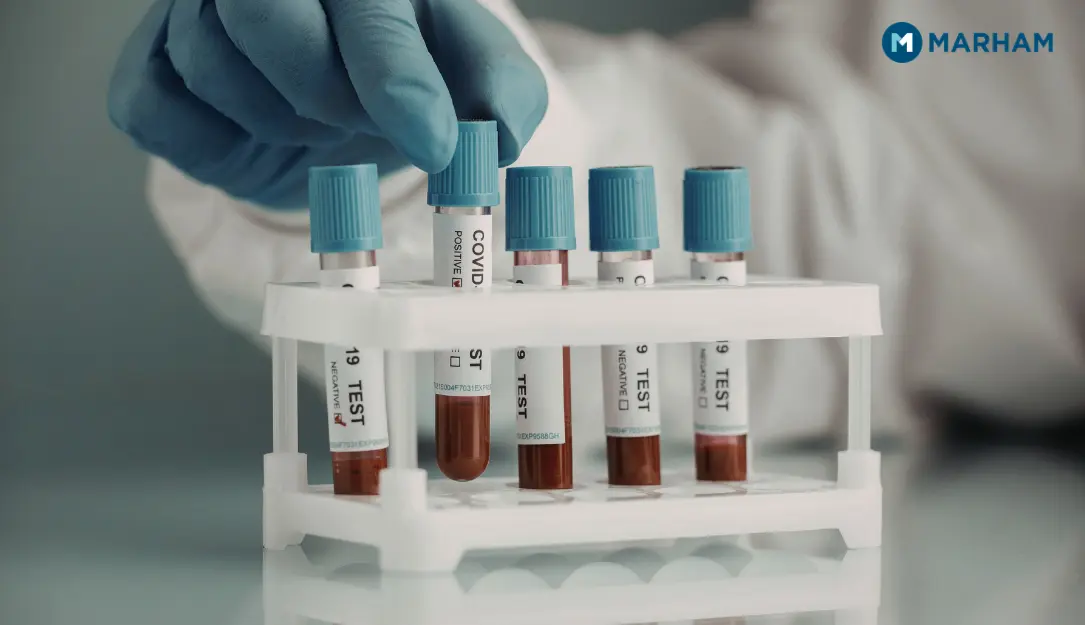 CBC test price in Pakistan 2026: Marham Lab PKR 640, Chughtai Lab PKR 640, Excel Labs PKR 840