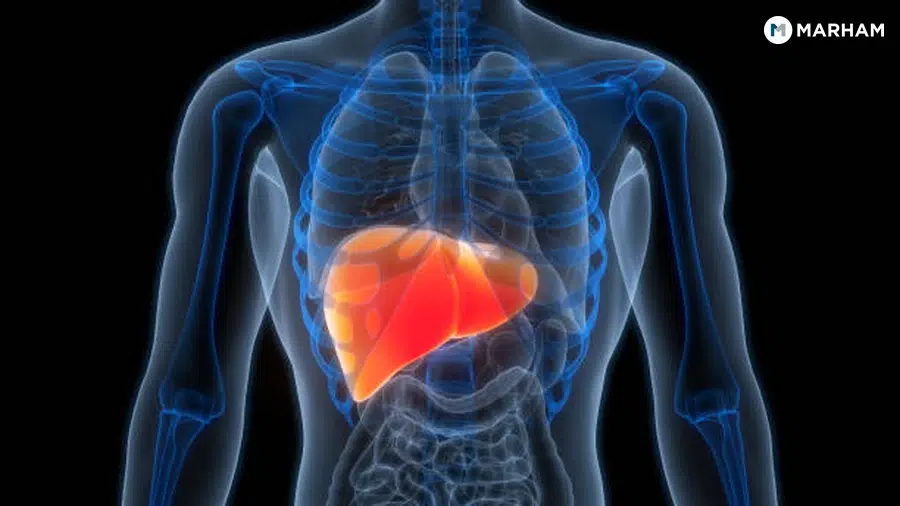 How Fatty Liver Is Diagnosed