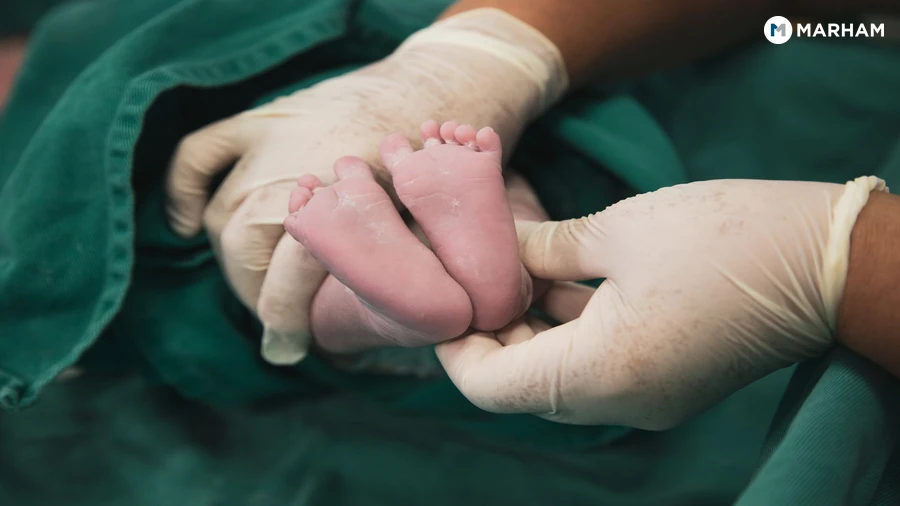 What Are Flat Feet (Pes Planus)?