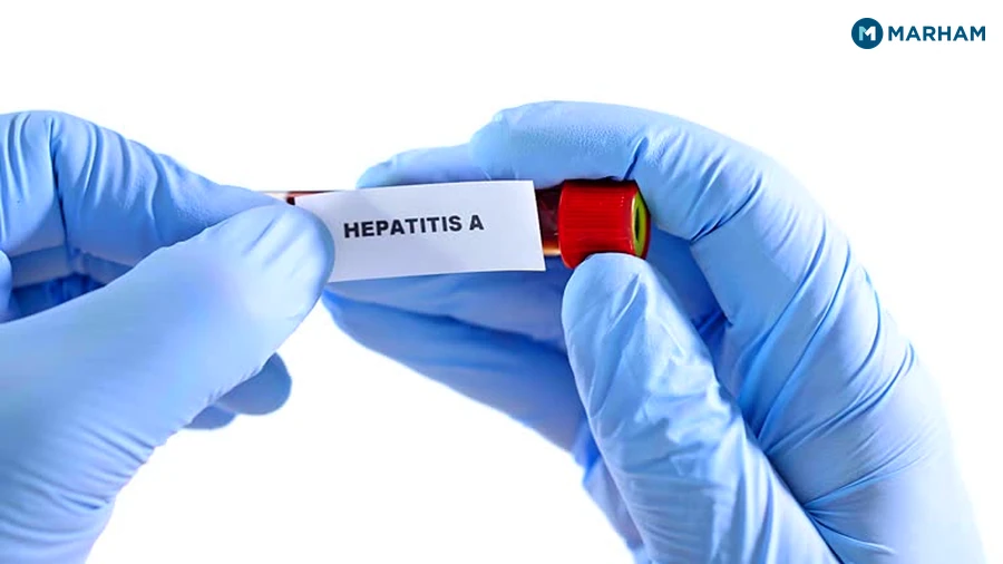 How Hepatitis A and E Spread in Pakistan