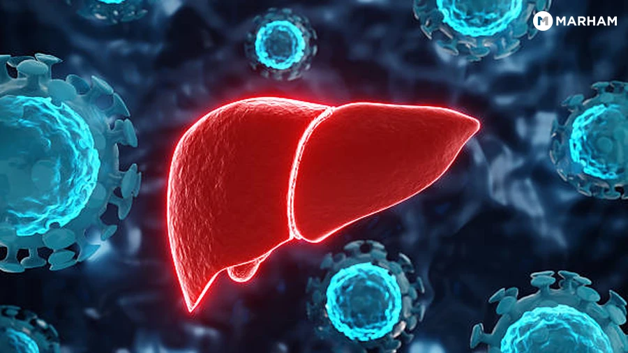 How to Prevent Hepatitis A and E in Pakistan
