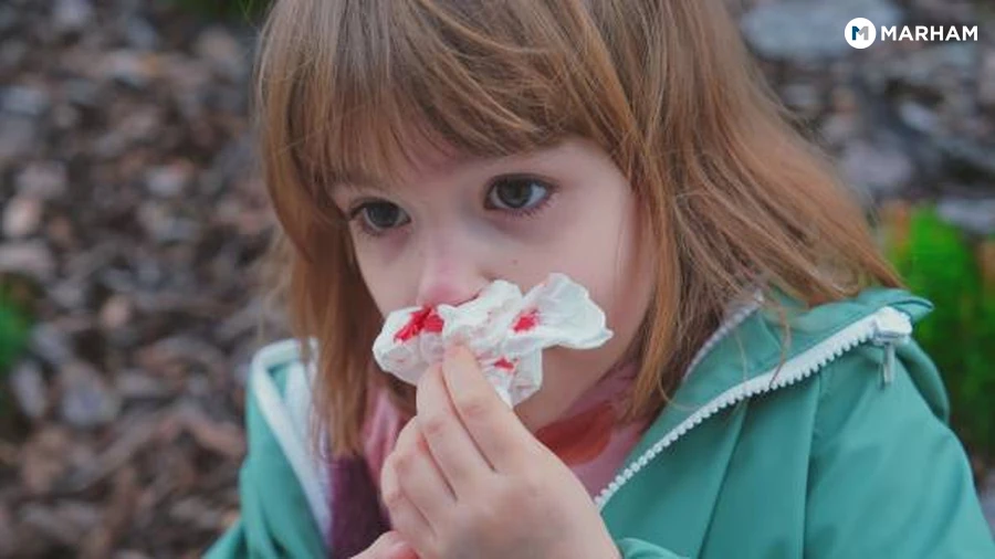 How to Prevent Nosebleeds During Pakistan's Garmi Season