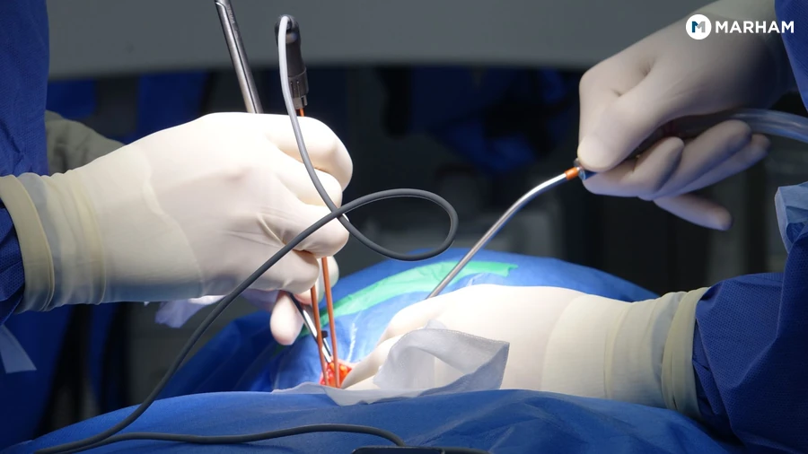 How to Relieve a Pinched Nerve: Step-by-Step