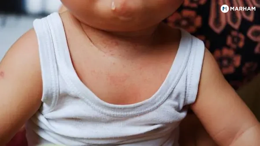 Why Pakistani Babies Get Ghamoriyan So Easily