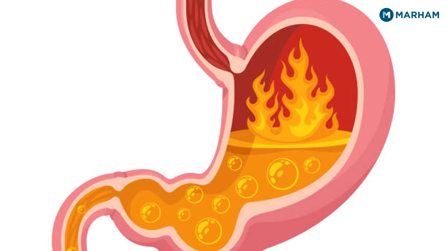 When to See a Doctor for Stomach Burning