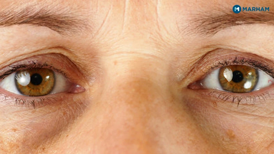 Key Nutrients That Support Eye Health