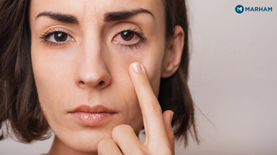 When to See a Doctor for Tired Eyes