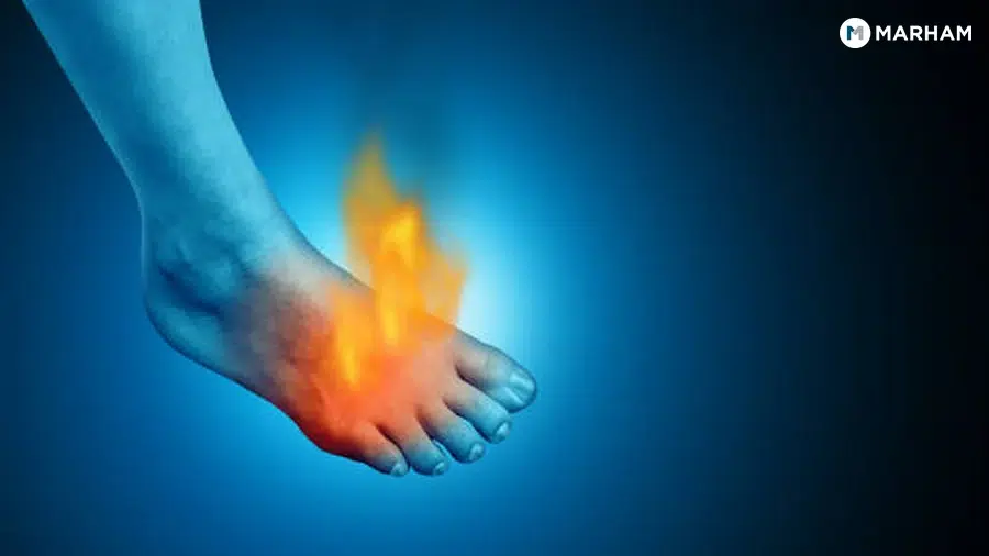 6. Tarsal Tunnel Syndrome