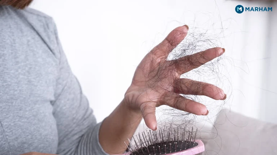 When Hair Fall Needs a Dermatologist, Not Just a New Shampoo