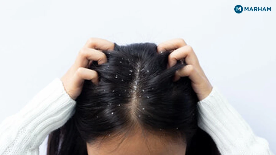Fungal Infection: Ringworm and Related Scalp Infections